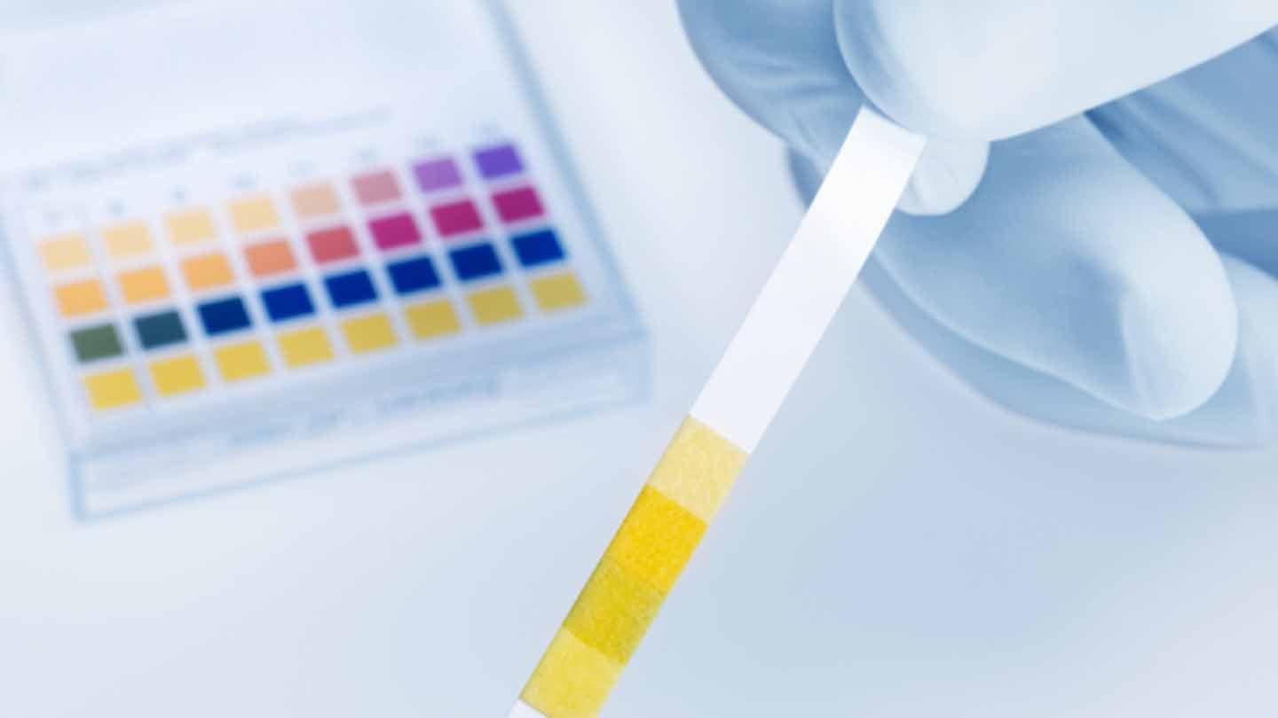 Захворювання нижніх сечових шляхів у котів - причини та лікування